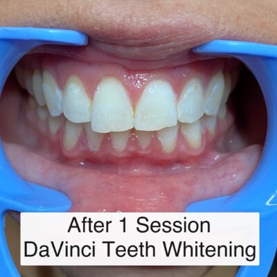 studio420teeth-3
